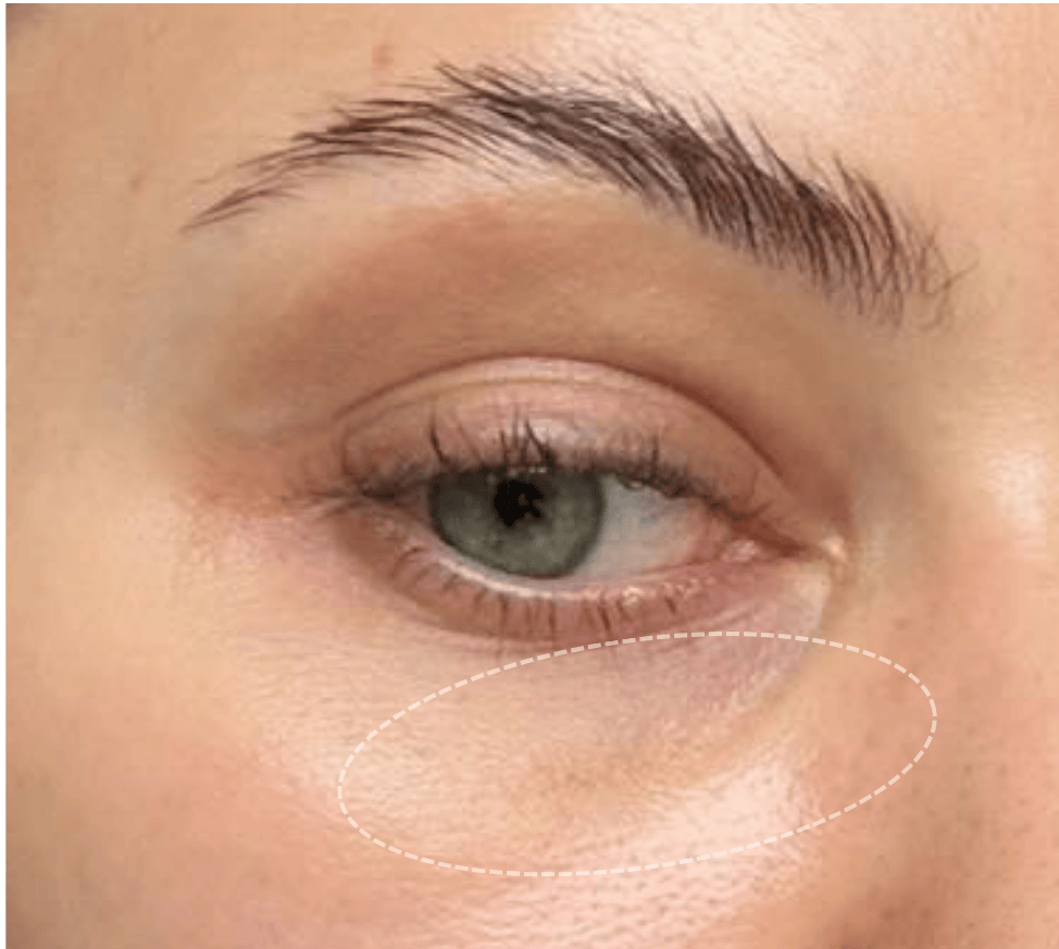 45 72 e1770224830649