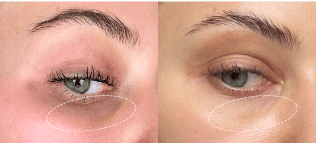 Marillys-vorher-nachher-Botanics - essential-Gesichtsanalyse-Supplemente