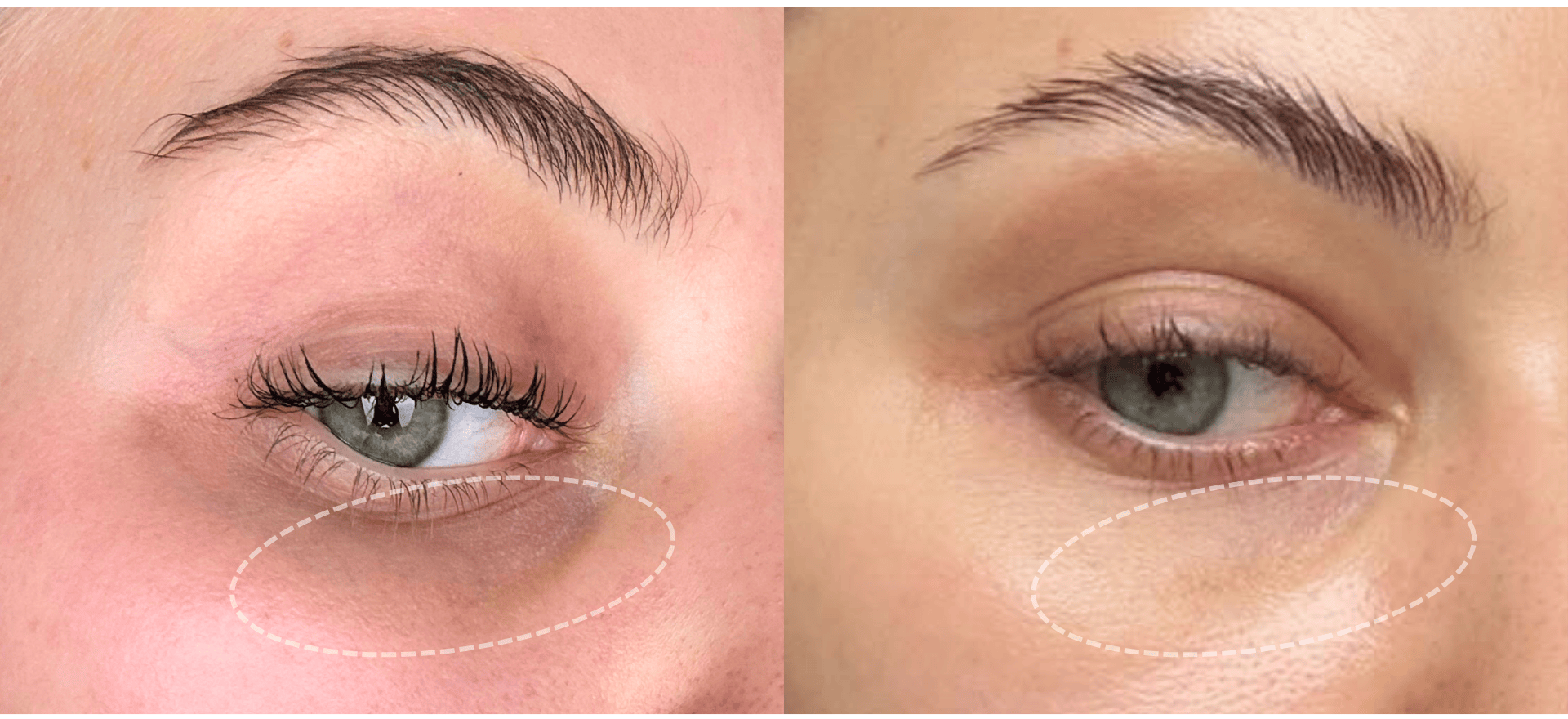 Marillys vorher nachher Botanics essential Gesichtsanalyse Supplemente e1770223926888