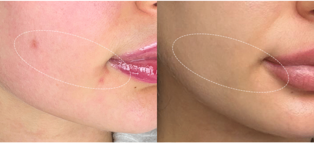 Marillys-Gesichtsanalyse-Pflanzenkapseln - persönlcihe Nahrungsergänzung