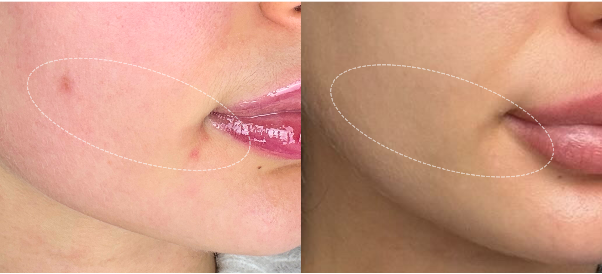 Marillys Gesichtsanalyse Pflanzenkapseln persoenlcihe Nahrungsergaenzung e1771517745571