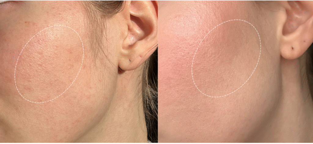 Personalisierte Nahrungsergänzung