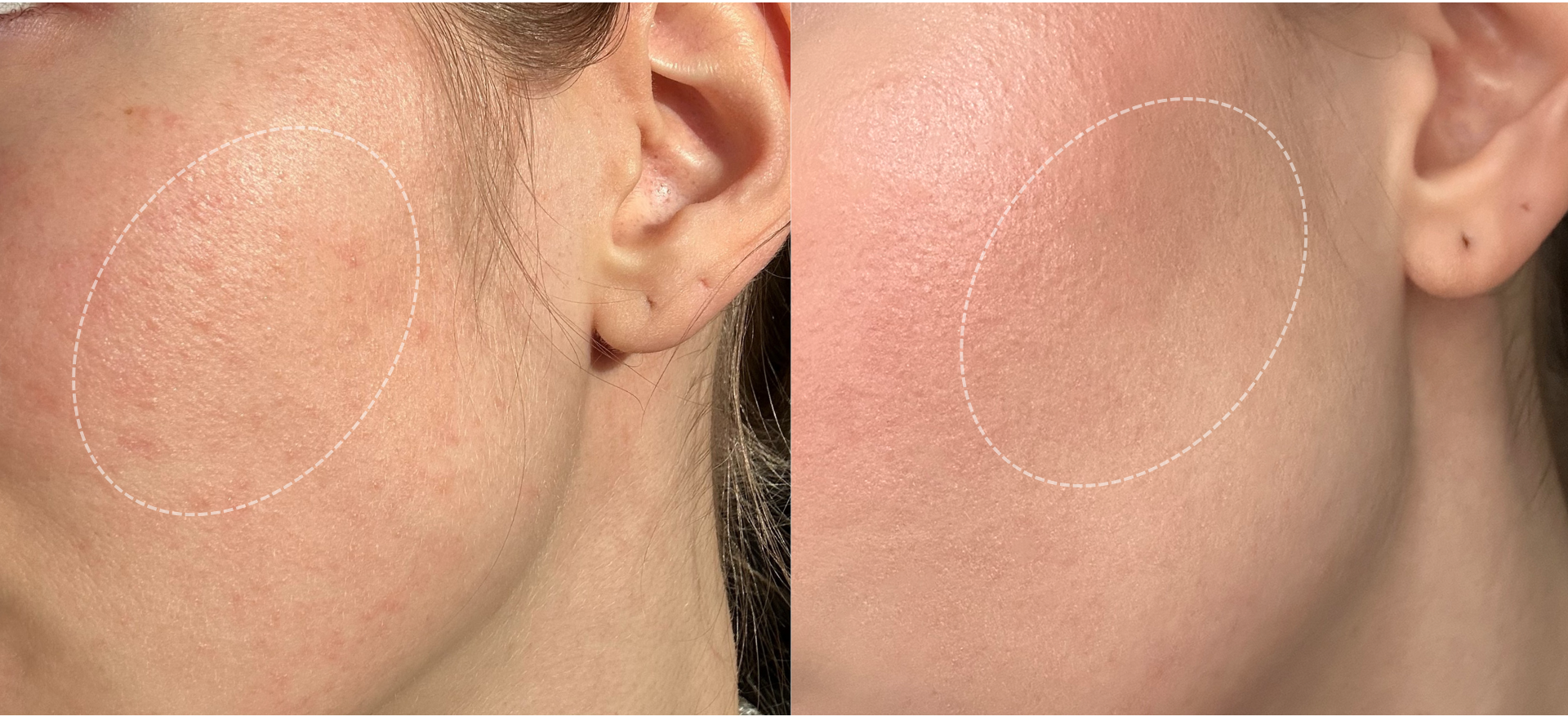 Personalisierte Nahrungsergaenzung e1771517726909