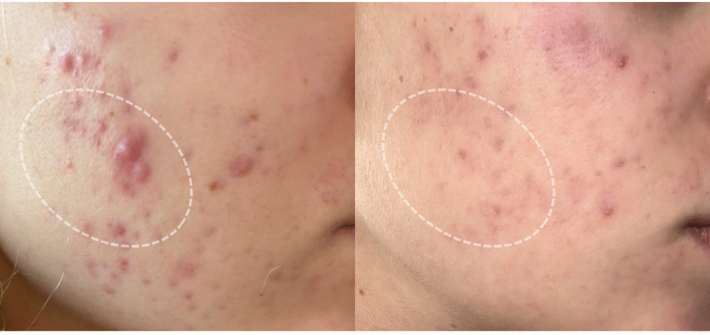 Skin 9 45 - 2026-05-24T133154.614